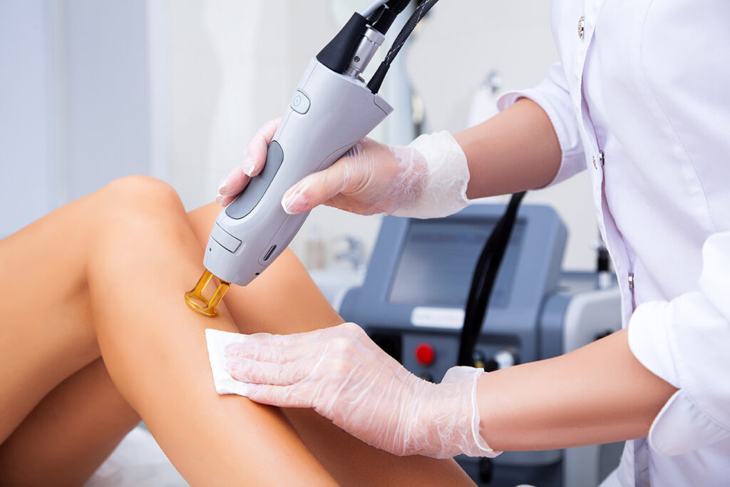 co2 laser hair removal